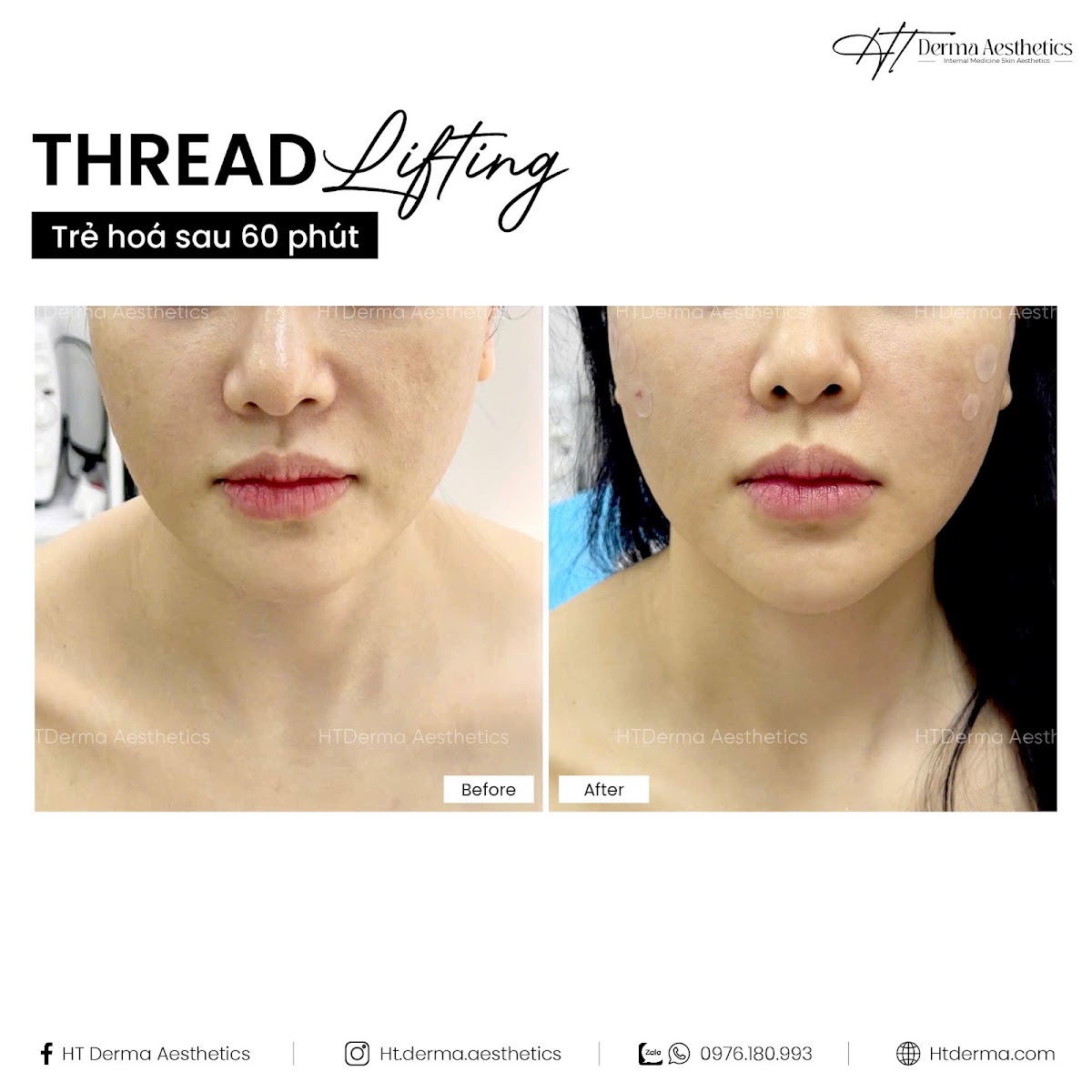 HT Derma Aesthetics Beauty & Spa