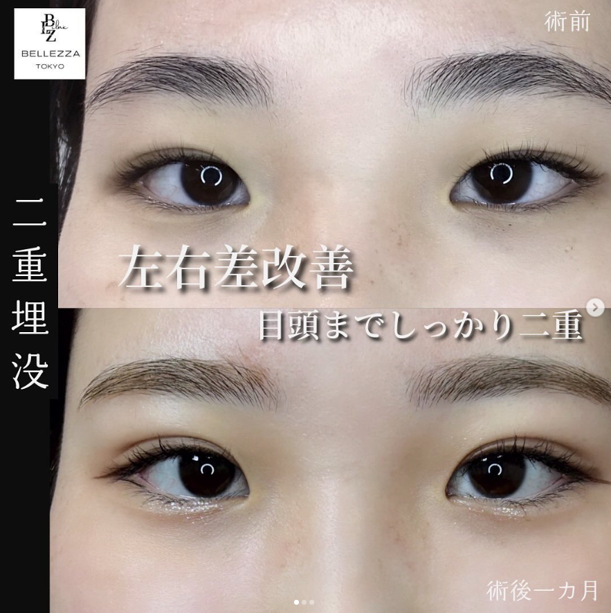 Tokyoberezza Clinic