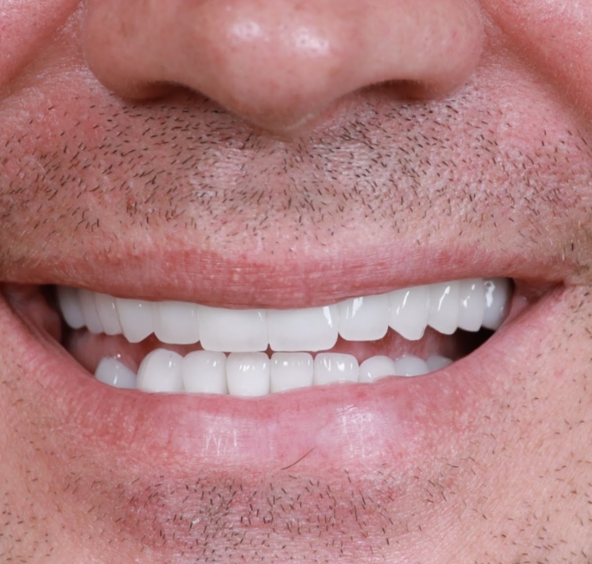 Worldwide Beauty And Dental Hospital