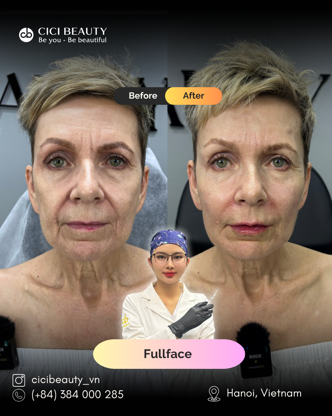Cici Beauty Aesthetic