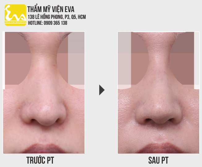 Center for Cosmetic Surgery Eva