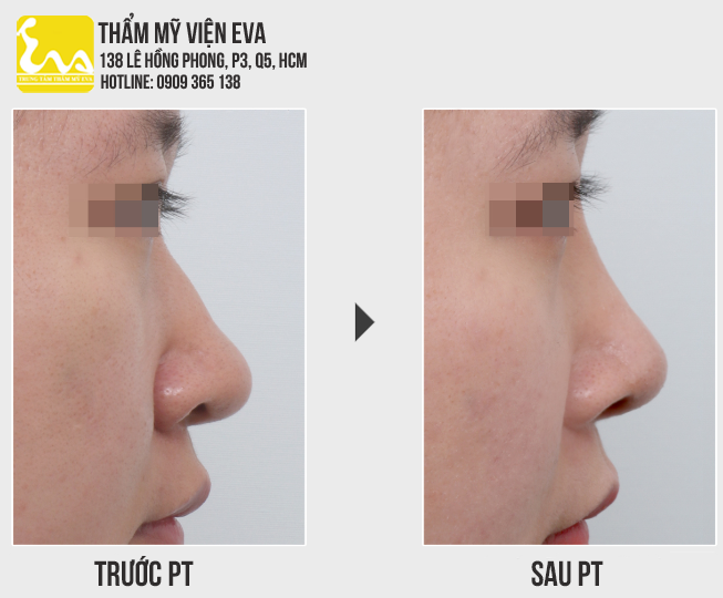 Center for Cosmetic Surgery Eva