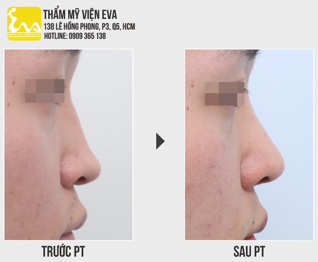 Center for Cosmetic Surgery Eva
