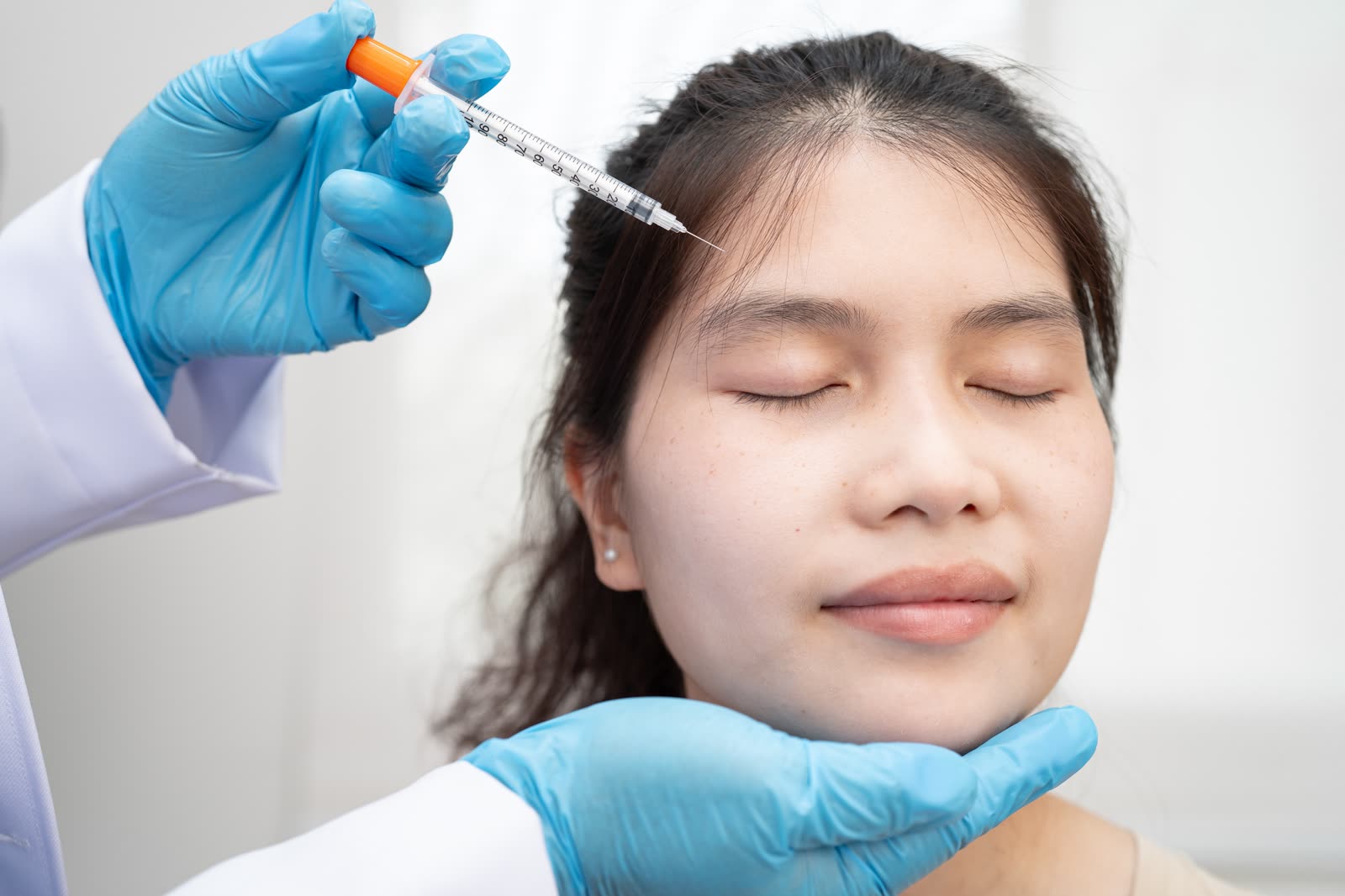 Hyaluronic Acid Filler