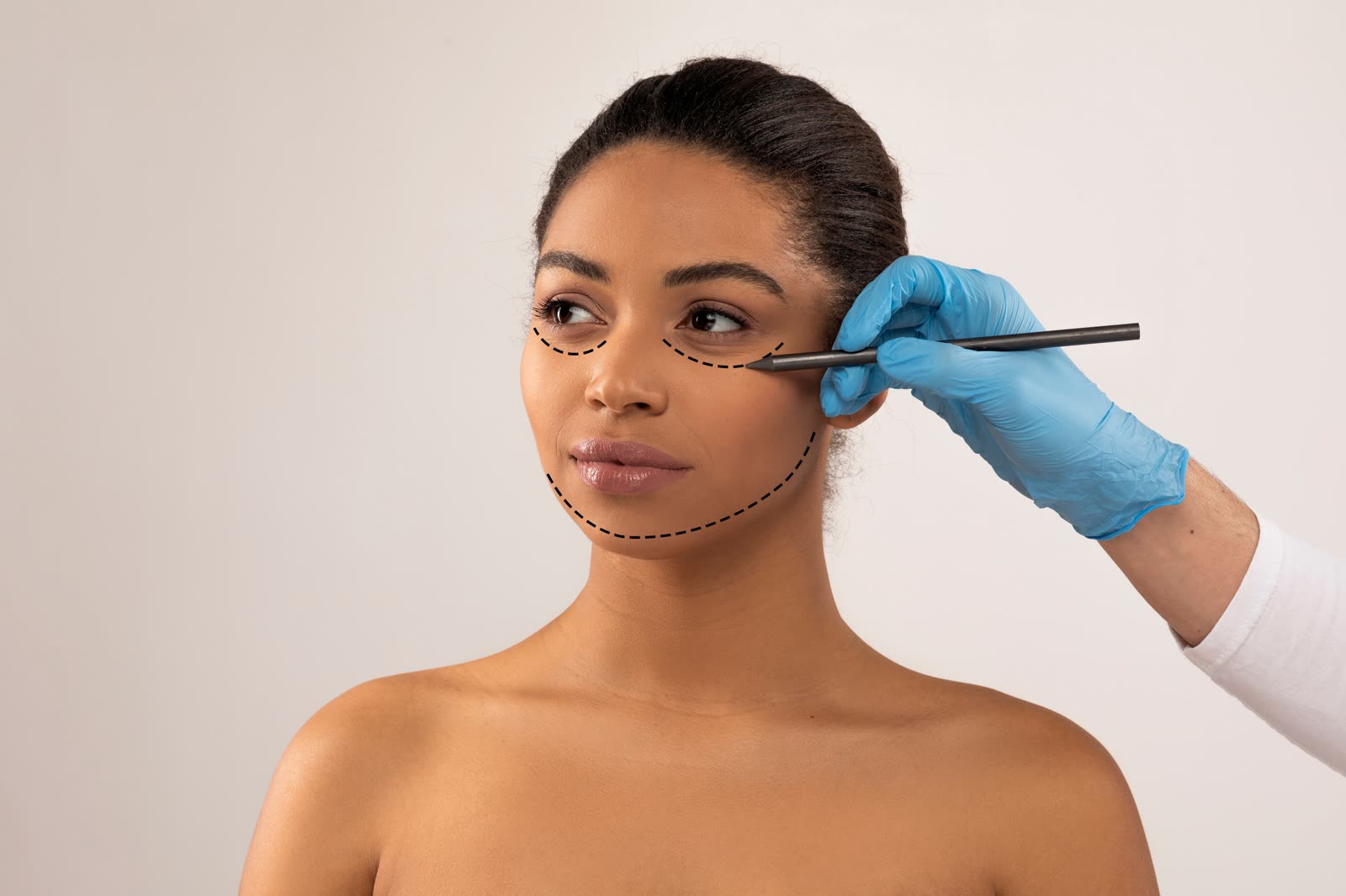 V-line Mandible Trim