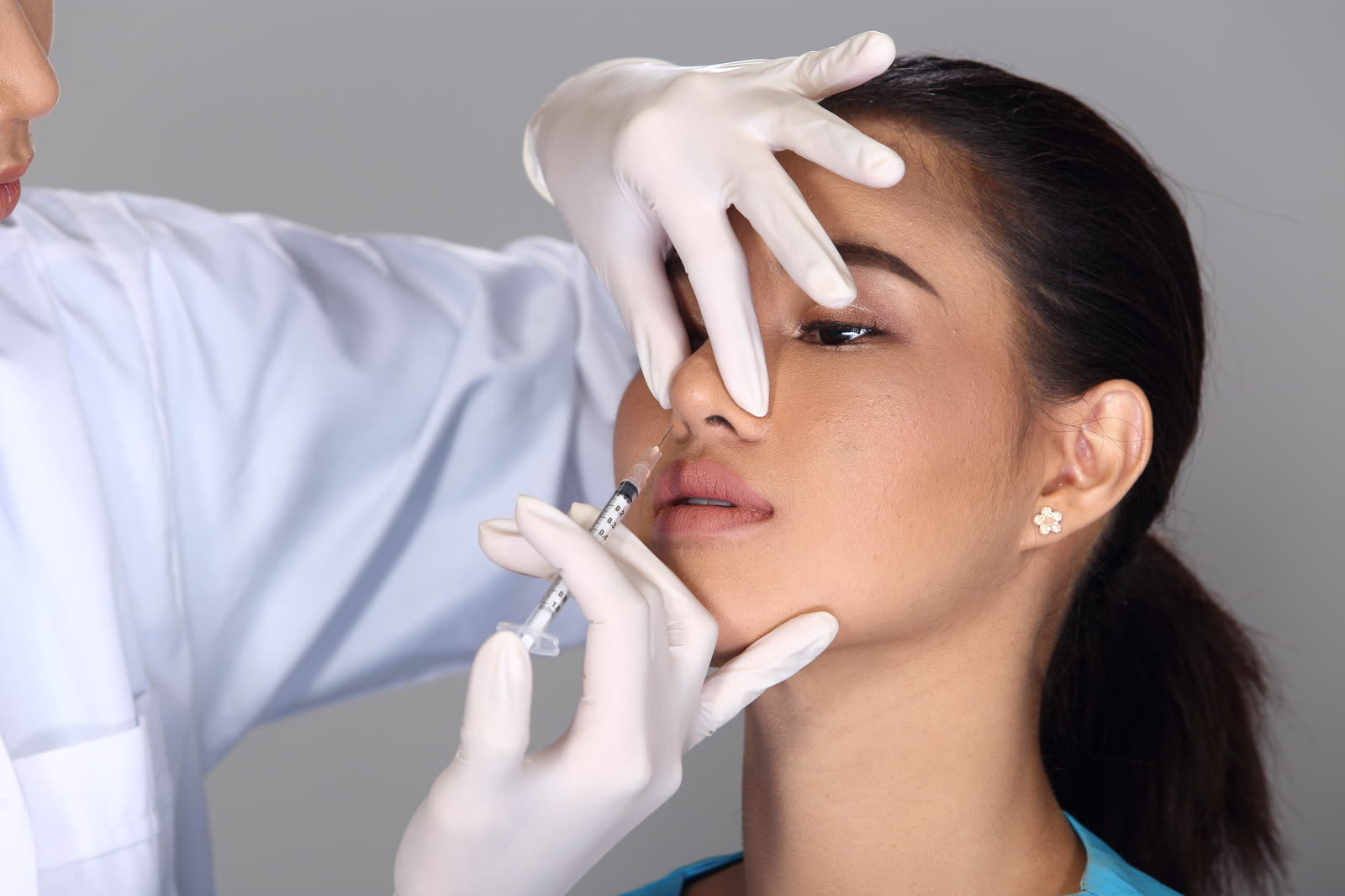 Nose Filler Injection (juvederm, Radiesse)