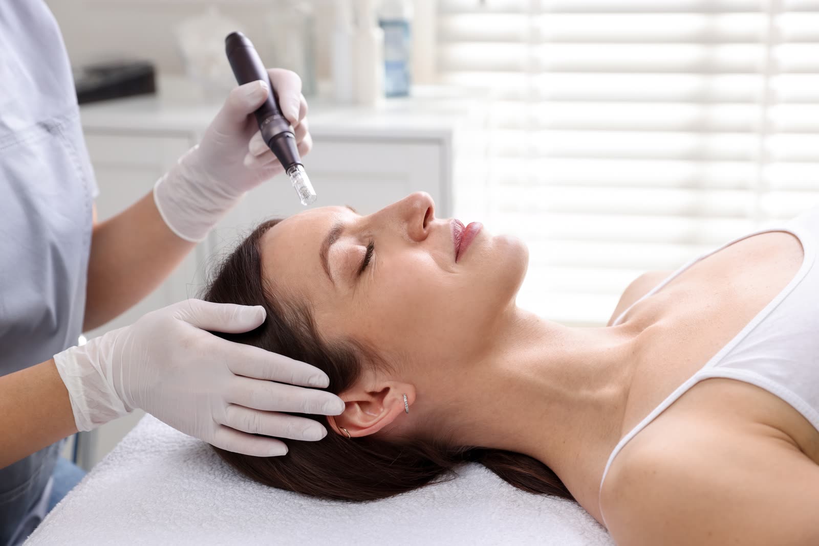 Blessing RF Microneedling
