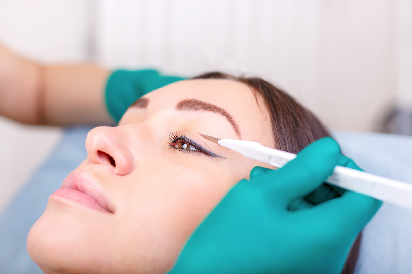 Blepharoplasty