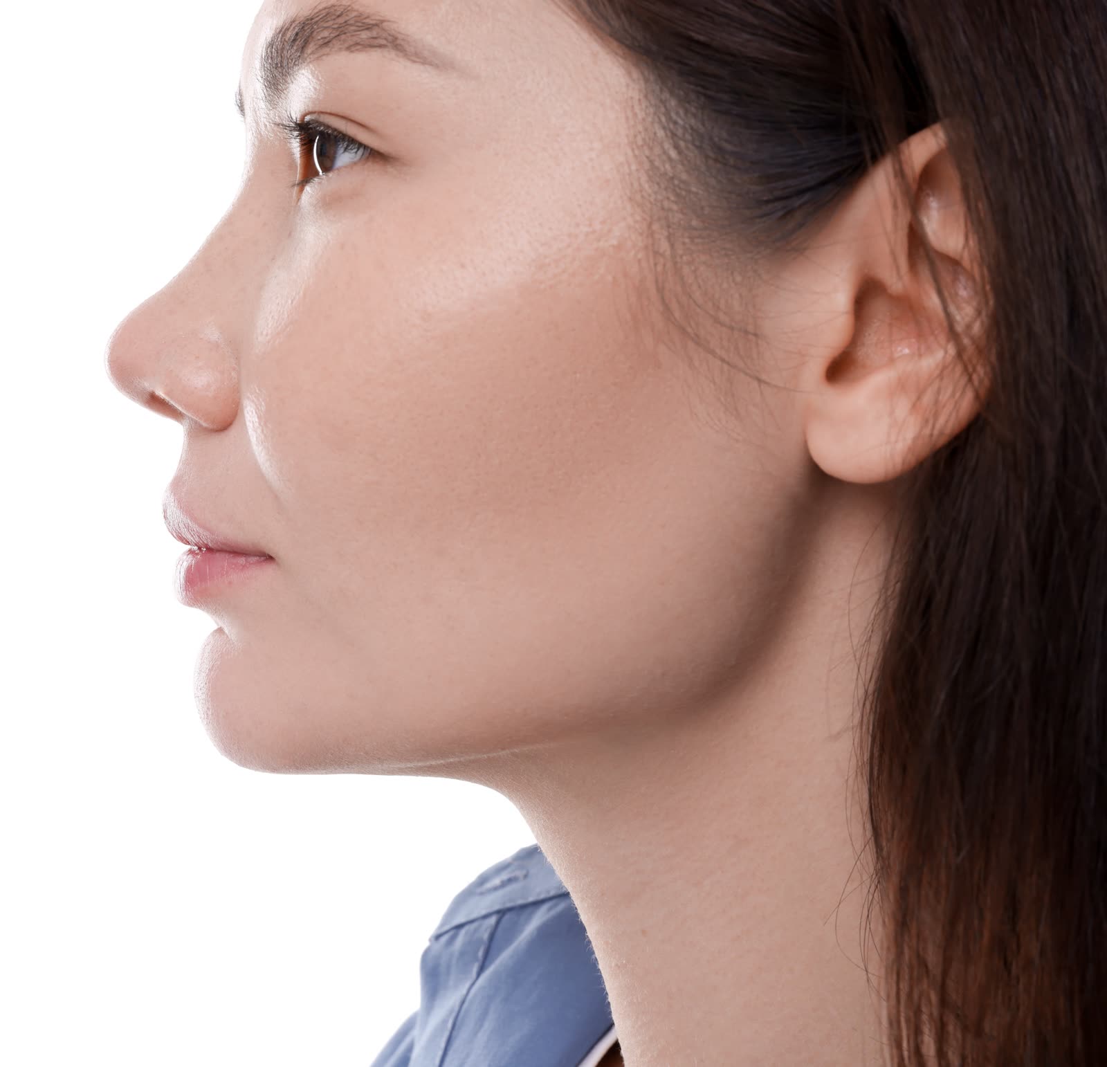 Rhinoplasty (svf)